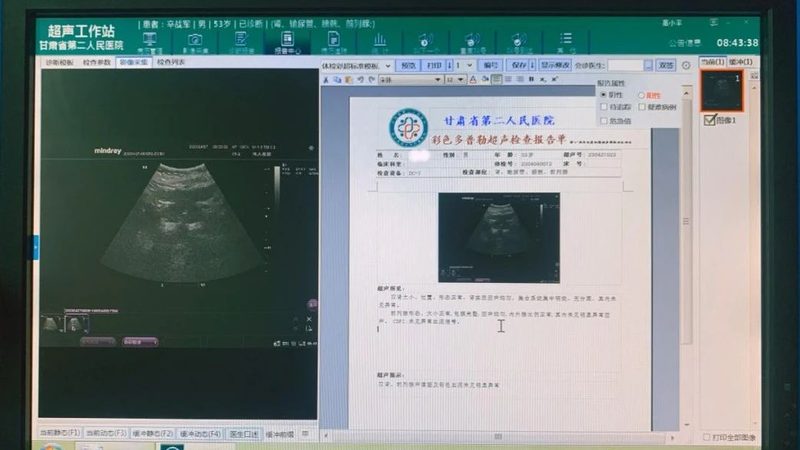 上海体检中心注意事项有哪些